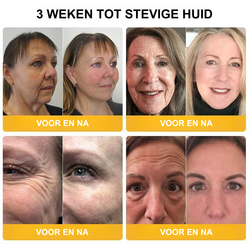 LiftedSkin™ | Anti-Aging Verstevigende Crème