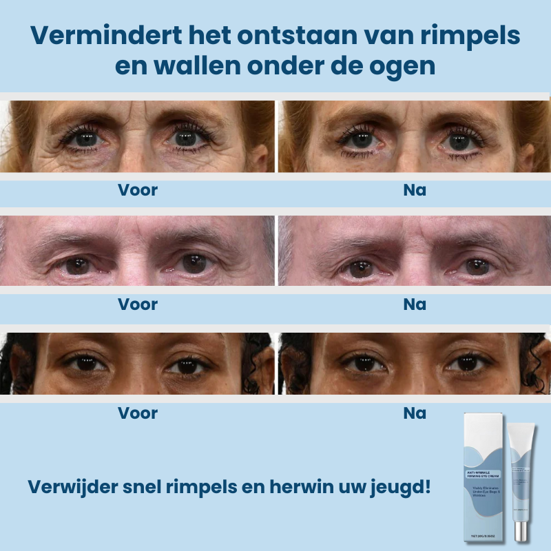 WrinClear™ | Anti-rimpel Oogcrème