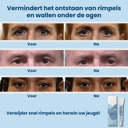 WrinClear™ | Anti-rimpel Oogcrème