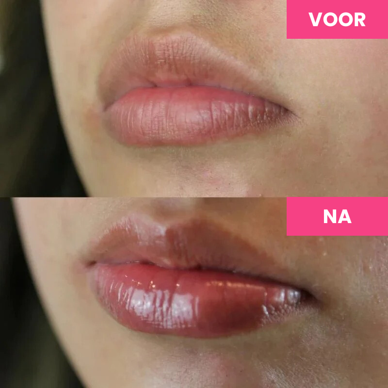 GlamPout™ | Lippen Groei Serum