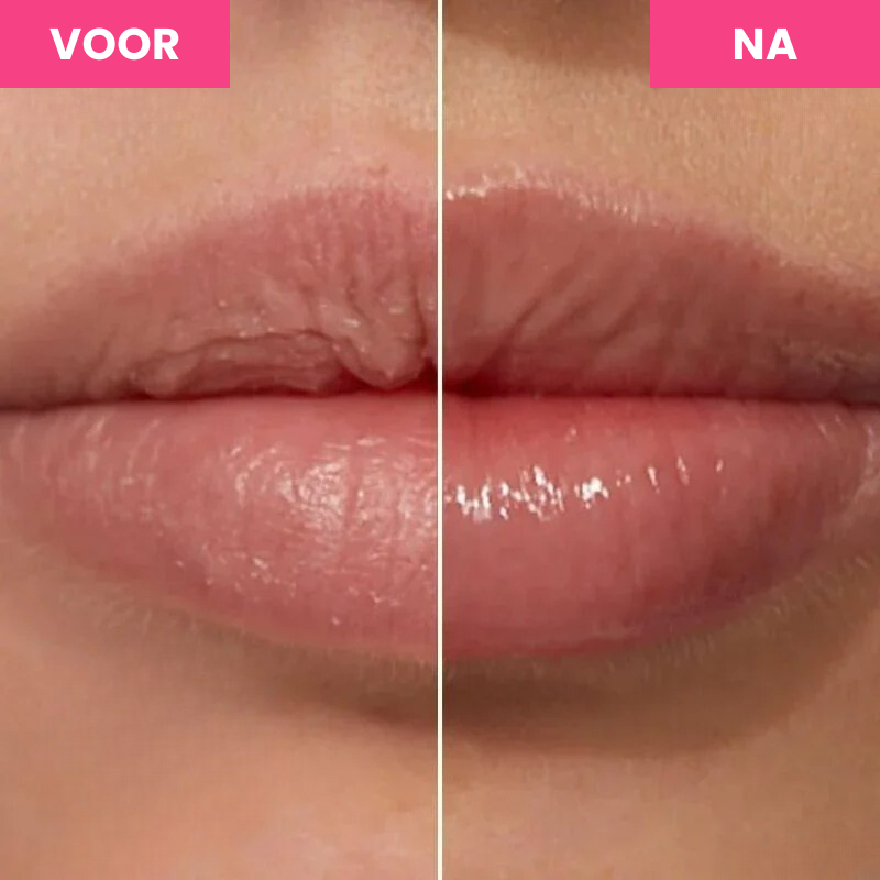 GlamPout™ | Lippen Groei Serum