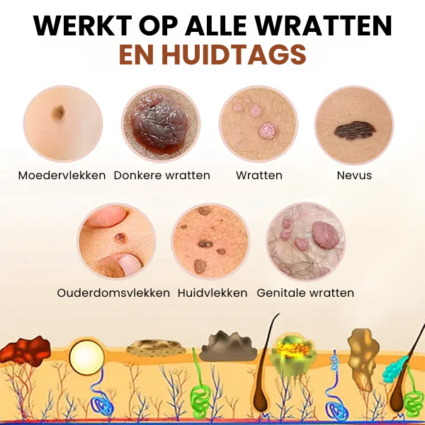 SpotGone™ | Moedervlek- en Wrattenbehandeling Crème