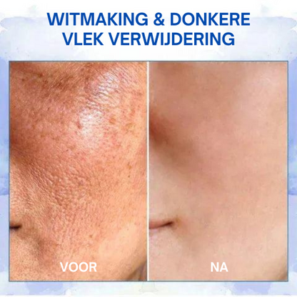RevytaFirm™ | Ultra Verstevigende en Revitaliserende Crème