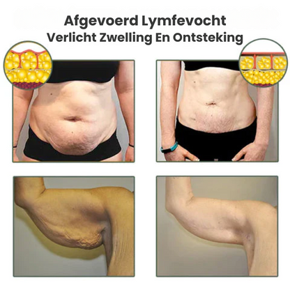 BURNYVA™ | Vetverbrandende Crème