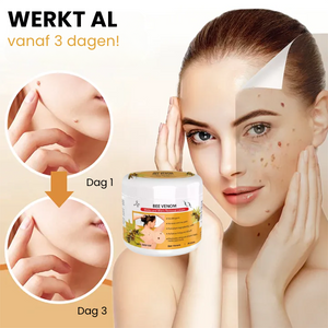 SpotGone™ | Moedervlek- en Wrattenbehandeling Crème