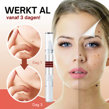 Tag Smooth™ | Huidtags en Moedervlekken Verwijderaar