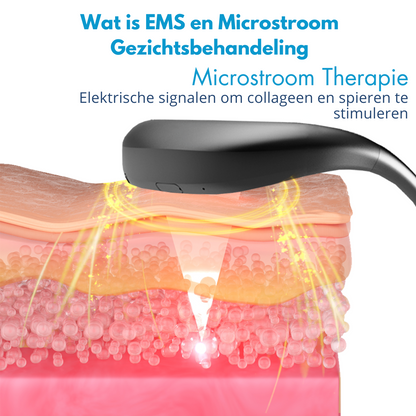 FynFace™ | Kaaklijn Liftend Apparaat