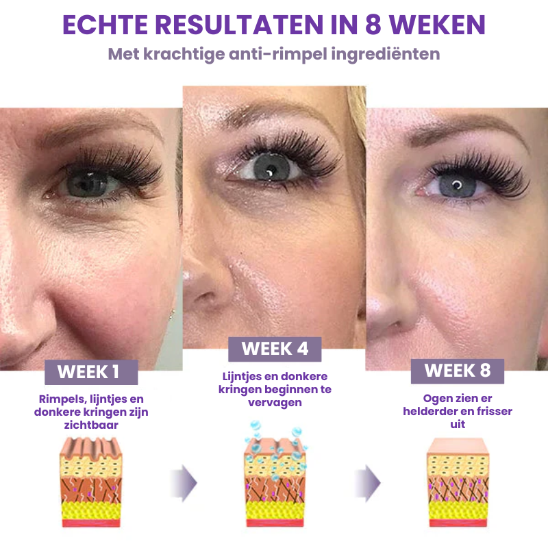 FREMCRYM™ | Verstevigende Oogcrème