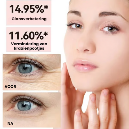 LYFTSKEEN™ | Anti-rimpel Serum