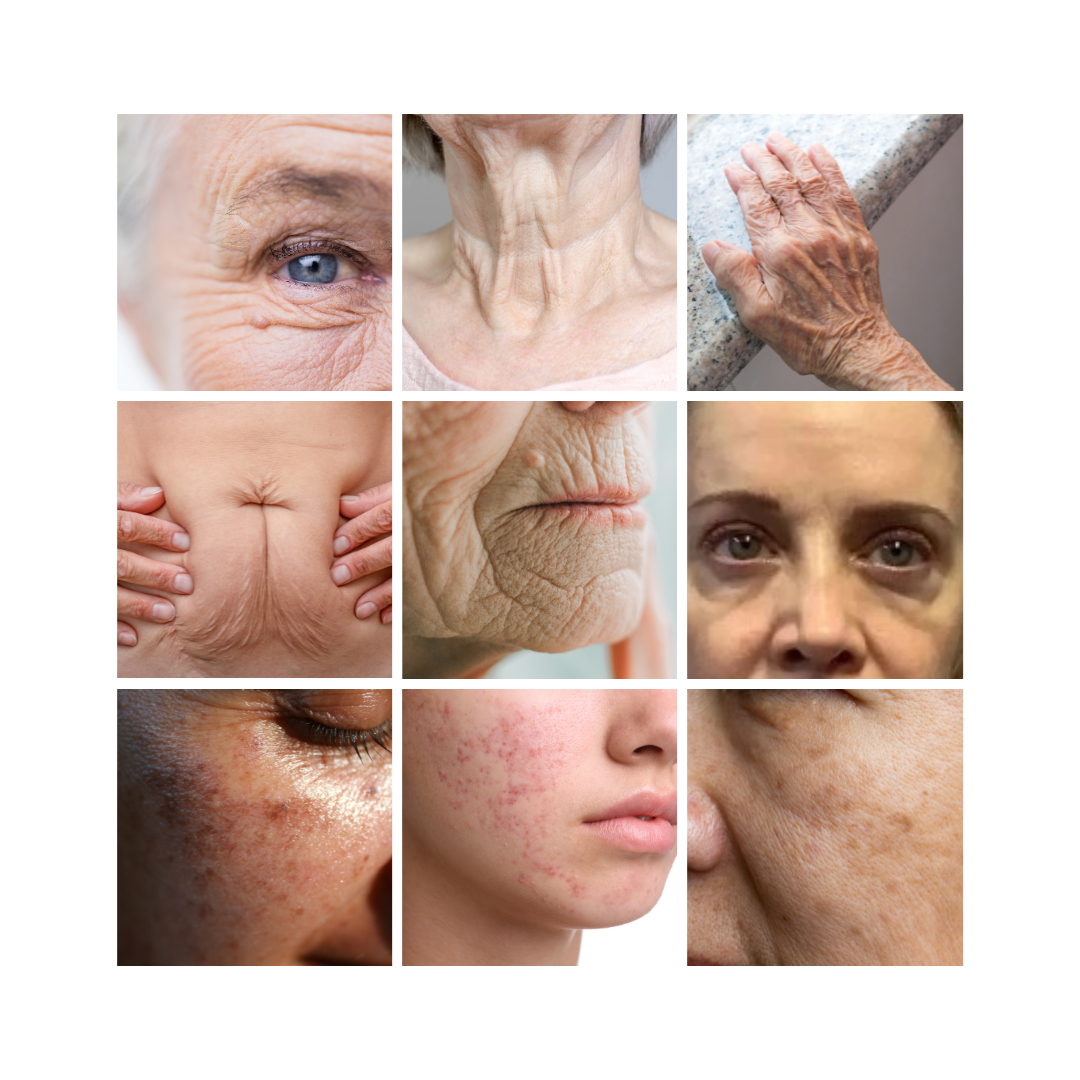 Reversal Peptide™ | Anti-rimpel Serum