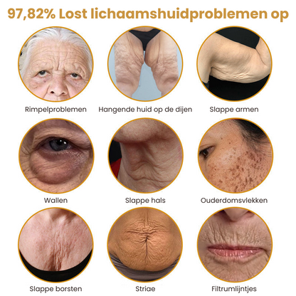 VenoFirm™ | Botox Rimpelverstevigende Crème