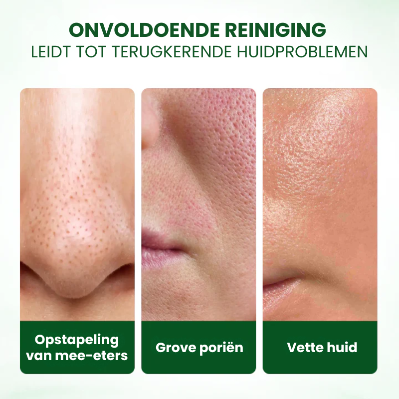 PORADICATE™ | Avocadozuurmasker