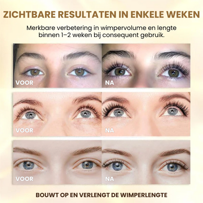 VYRELLASH™ | Wimpergroei Serum