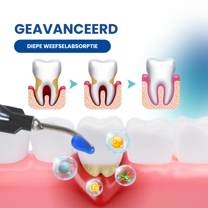 GUMMCARE™ | Tandvleesverzorgende Essentie