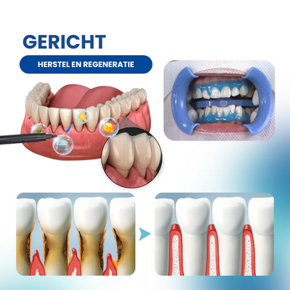GUMMCARE™ | Tandvleesverzorgende Essentie