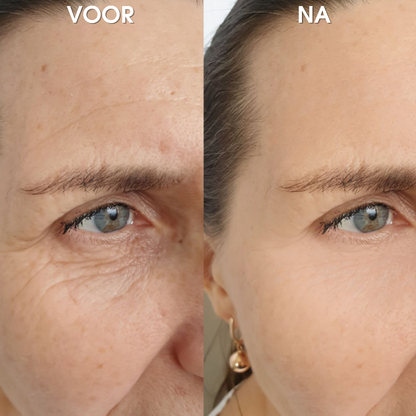 1+1 GRATIS: AntiAge™ | Rimpelcorrectie Crème
