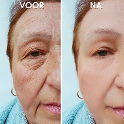 UltraLift™ | Rimpel Herstellend Serum