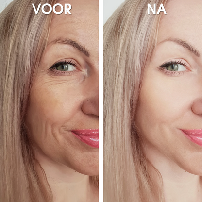 UltraLift™ | Rimpel Herstellend Serum