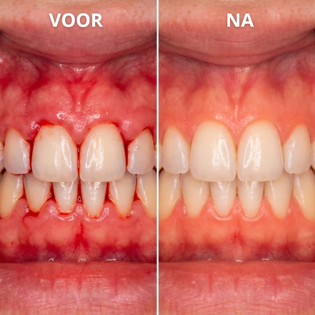 1+1 GRATIS: OralGlow™ | Tandvleesverzorgende Essentie Gel