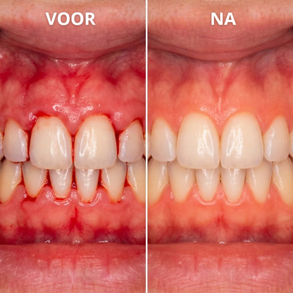 1+1 GRATIS: OralGlow™ | Tandvleesverzorgende Essentie Gel