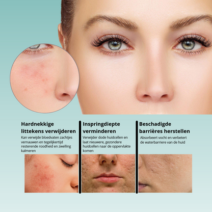 1+1 GRATIS: GlowSkin™ | Huid Egalisatie Serum