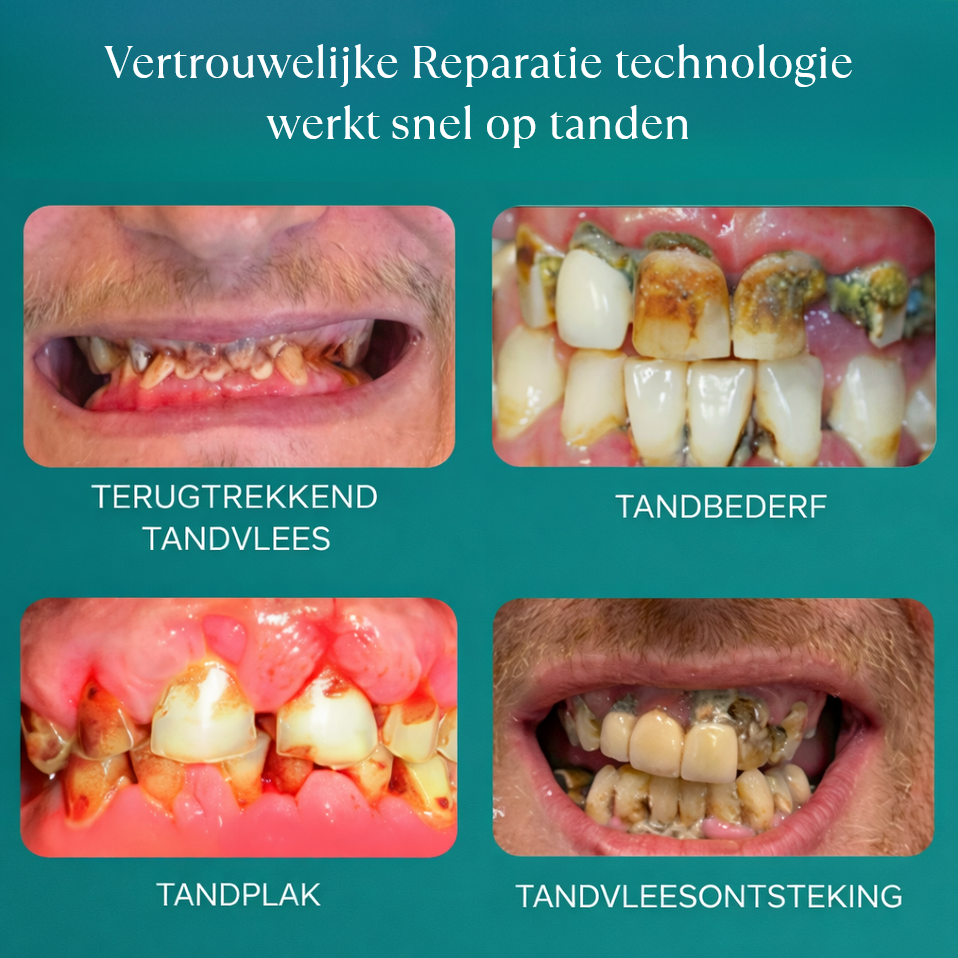 1+1 GRATIS: DentaSmile™ | Tandverzorgend Mineraalpoeder