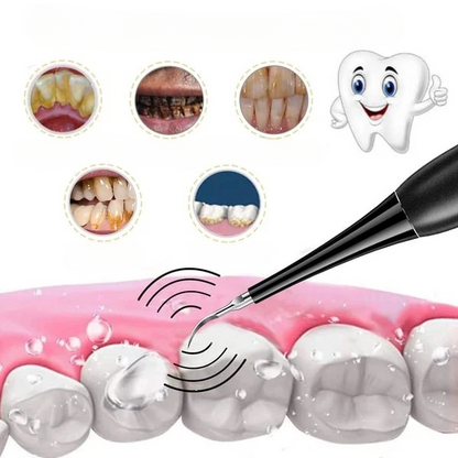 CleanPro 2.0™ | Elektrische Tandreiniger