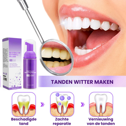 TRUWITOOTH™ | Tanden Bleken Mousse