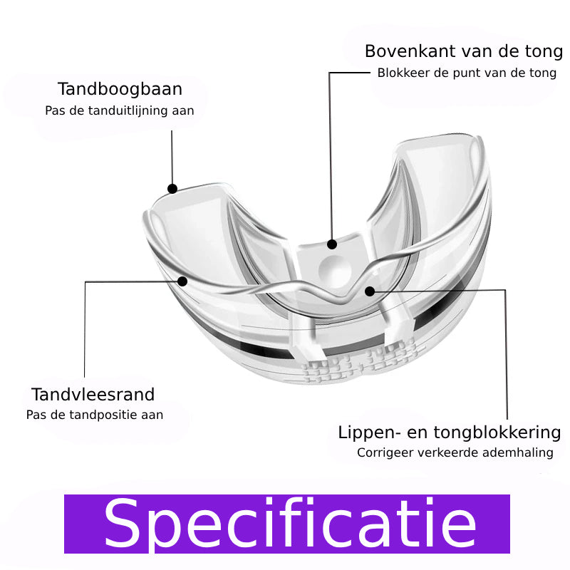 Perfecte Glimlach Align™ | Tanduitlijningsbeugel