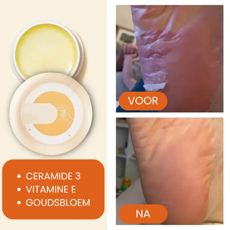 NOURISA™ | Droge en Schrale Huid Crème