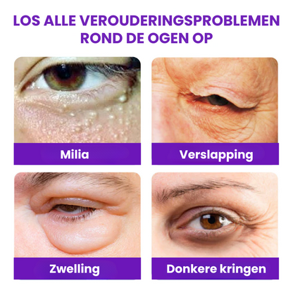 OPTILIFTIN™ | Herstellende Ooghuidcrème