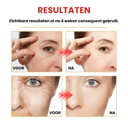 SYRUMIVA™ | Anti-verouderingsserum