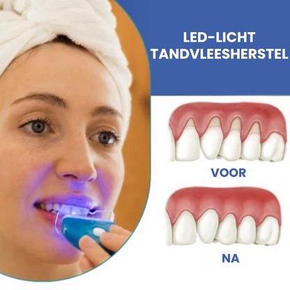LICHTORAL™ | LED-licht Tandvleesherstel