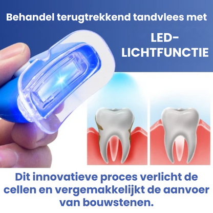 LICHTORAL™ | LED-licht Tandvleesherstel