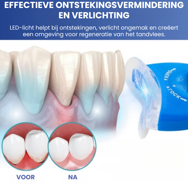 LICHTORAL™ | LED-licht Tandvleesherstel