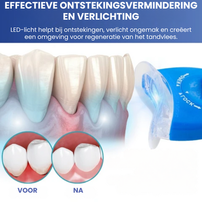 LICHTORAL™ | LED-licht Tandvleesherstel