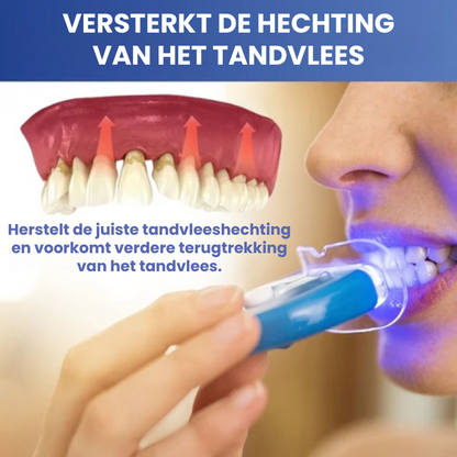 LICHTORAL™ | LED-licht Tandvleesherstel