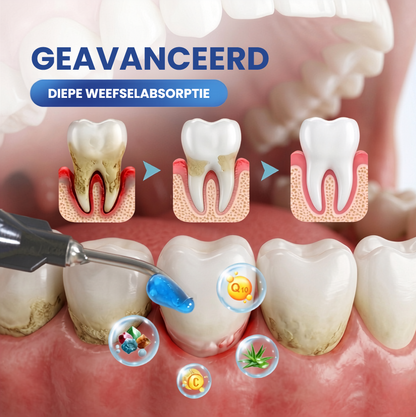 GUMMCARE™ | Tandvleesverzorgende Essentie