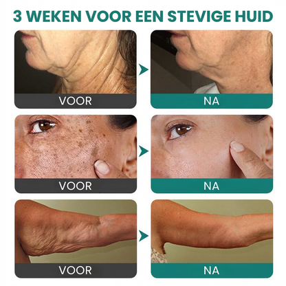 1+1 GRATIS: FirmAge™ | Rimpelverstevigende Crème