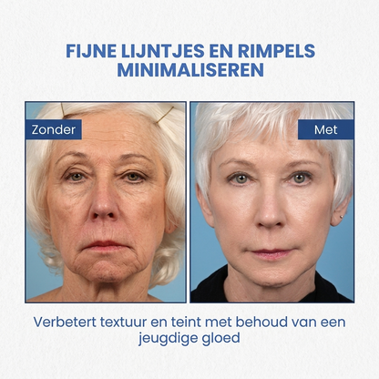 SkinLift™ | Botox Gezicht Serum