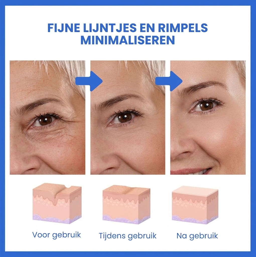 SkinLift™ | Botox Gezicht Serum