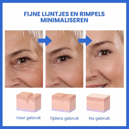 SkinLift™ | Botox Gezicht Serum