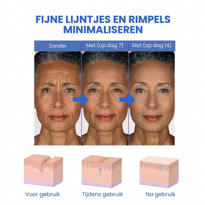 SkinLift™ | Botox Gezicht Serum