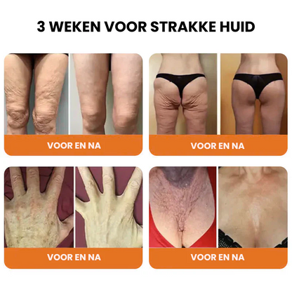 LIFTACULE™ | Huidverstevigende Crème