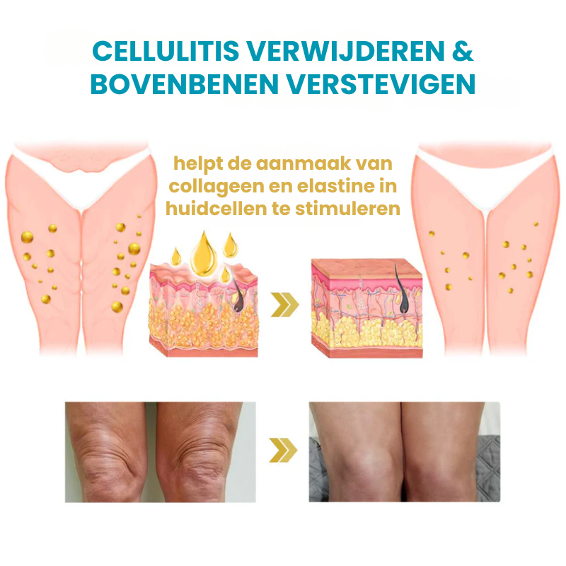 LIFTACULE™ | Huidverstevigende Crème