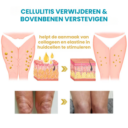 LIFTACULE™ | Huidverstevigende Crème