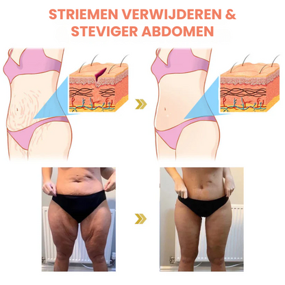 LIFTACULE™ | Huidverstevigende Crème