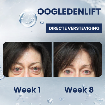 OOGLIVATE™ | Oogherstellende Crème