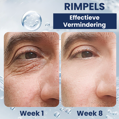 OOGLIVATE™ | Oogherstellende Crème