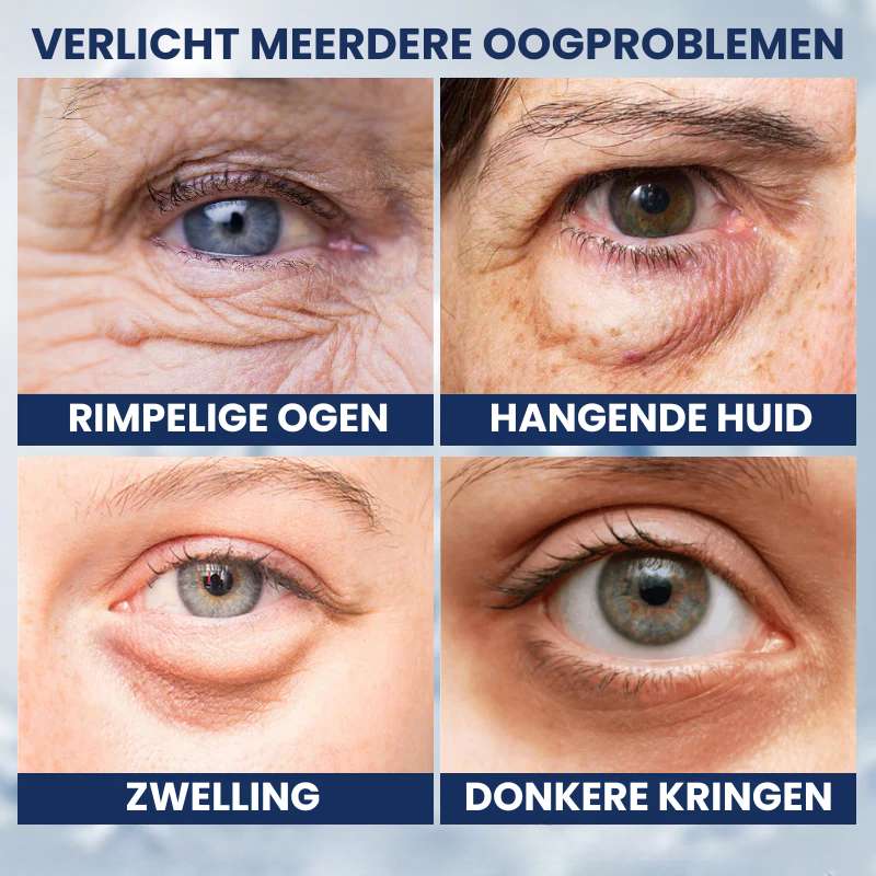 OOGLIVATE™ | Oogherstellende Crème